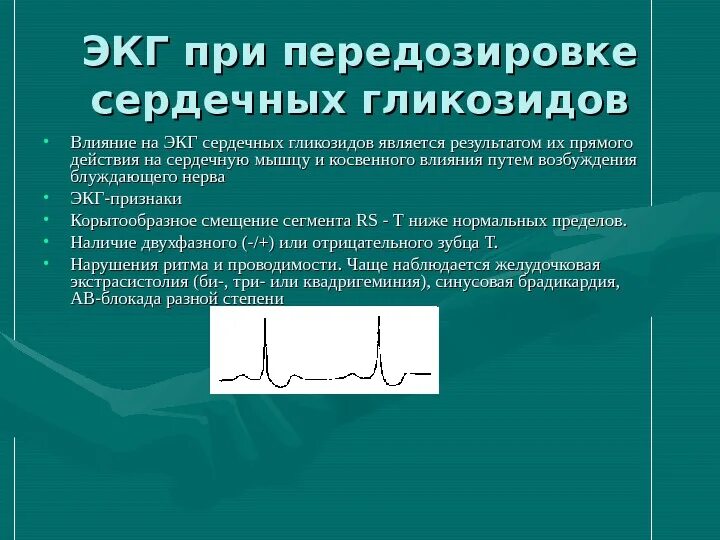 Сердечными гликозидами являются. Передозировка сердечными гликозидами на ЭКГ. Интоксикация сердечными гликозидами на ЭКГ. ЭКГ при передозировке сердечными гликозидами. ЭКГ признаки интоксикации сердечными гликозидами.