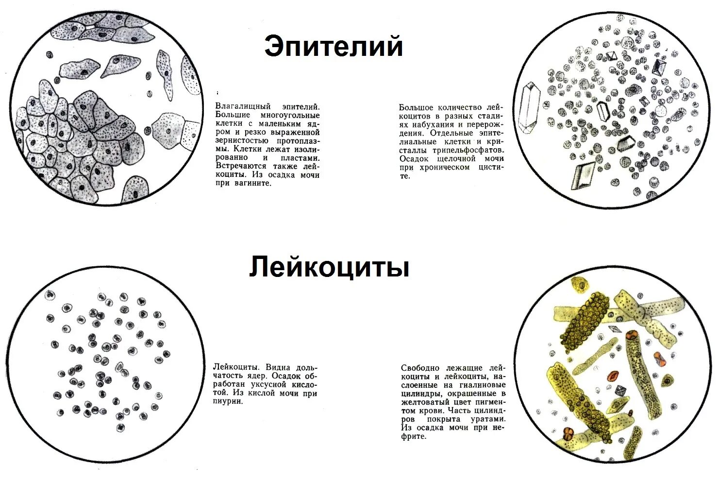 Микроскопические осадки мочи