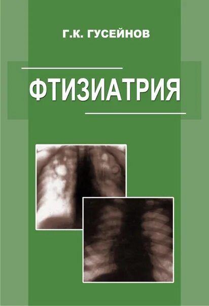 Туберкулез книга. Фтизиатрия. Перельман, м. и. фтизиатрия. Фтизиатрия учебник. Туберкулез учебник.