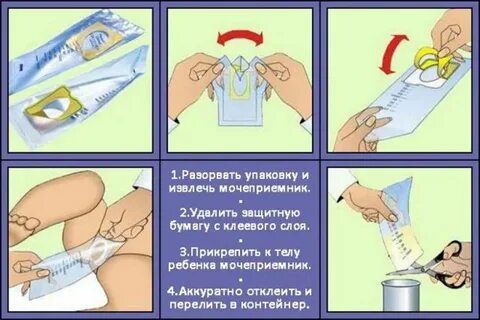 Общий анализ мочи подмываться