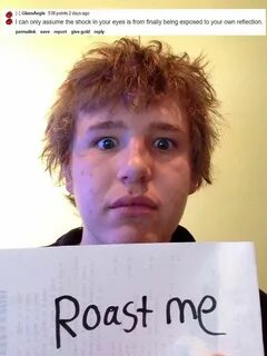 Your exposed