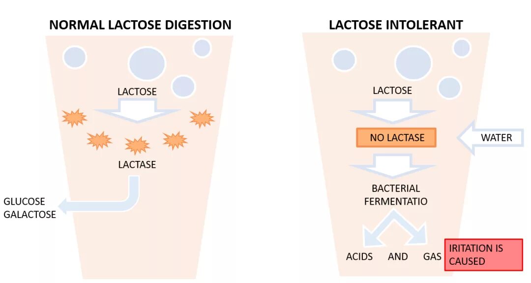 Ферментация лактозы. Непереносимость лактозы. Лактазная недостаточность. Непереносимость лактозы симптомы. Признаки непереносимости лактозы.
