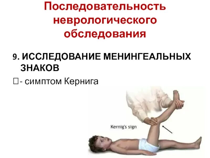 Ригидность мышц затылка симптом кернига. Симптомы менингита кернига брудзинского. симптом кернига неврология. менингеальные симптомы у взрослых.