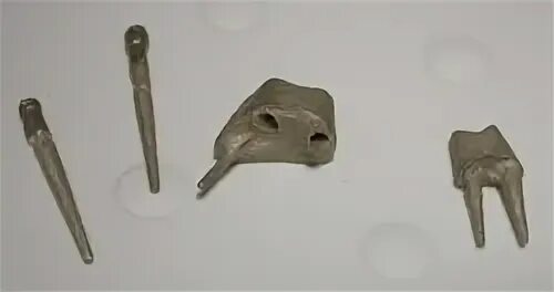 Разборные вкладки. Разборные вкладки. Цельнолитая культевая вкладка. Вкладка литая культевая кобальт -хромовый сплав. Разборная культевая штифтовая вкладка.