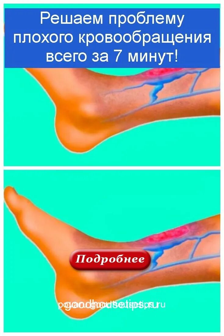 Проблемы с кровообращением симптомы. Проблемы с кровотоком. Нарушение кровообращения клинические проявления. Проблемы с кровообращением. Нарушение кровоснабжения головного мозга.