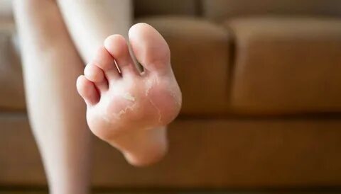 Open your feet