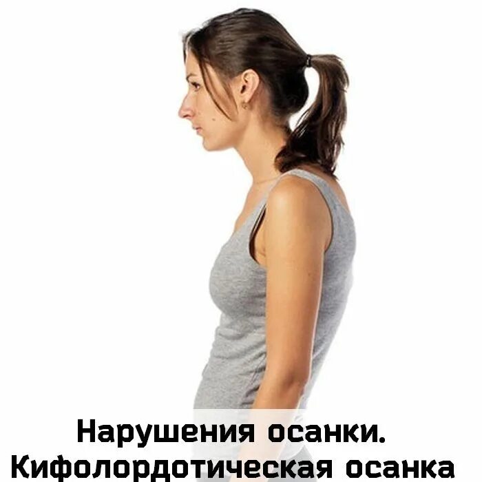 Ухудшение осанки