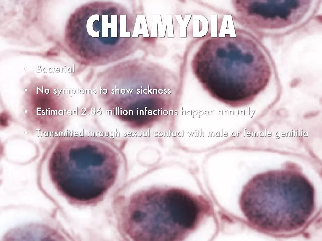 Хламидия в организме. Хламидия пневмония под микроскопом. Хламидии пневмония микроскопия. Chlamydophila pneumoniae морфология.