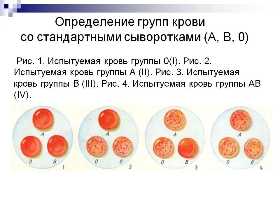 Реакции агглютинации для определения группы крови и резус-фактора. Определение групп крови по стандартным сывороткам. Методика определения группы крови с помощью стандартных сывороток. Определение группы крови с помощью стандартных сывороток. Резус фактор крови определение цоликлонами