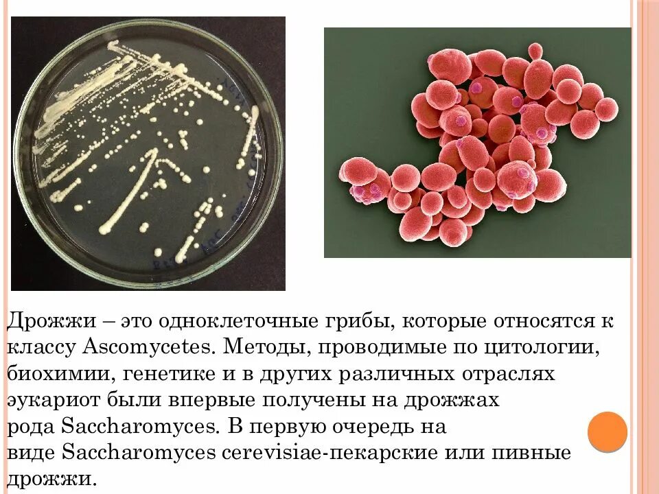 Эукариоты кишечная палочка. Дрожжи рода Saccharomyces. Дрожжи сахаромицеты строение. Геном дрожжей Saccharomyces cerevisiae.. Saccharomyces cerevisiae морфология.