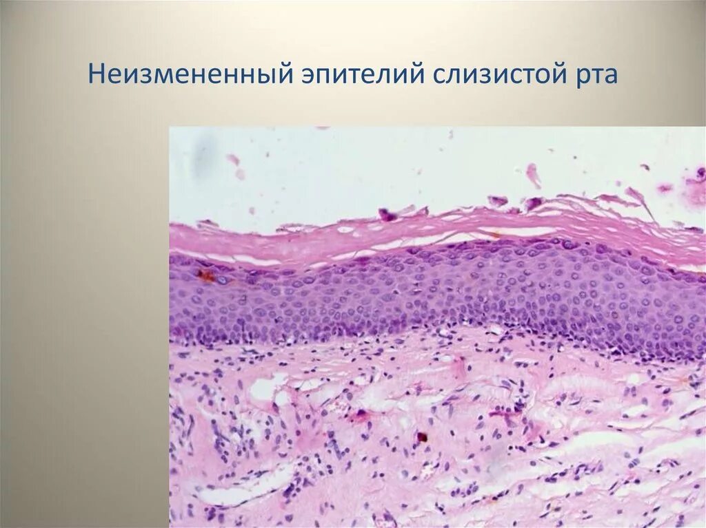 Многослойный эпителий ротовой полости. Микропрепарат эпителий полости рта. Эпителий слизистой оболочки полости рта микропрепарат. Многослойный плоский эпителий слизистой оболочки полости. Клетки слизистой полости рта