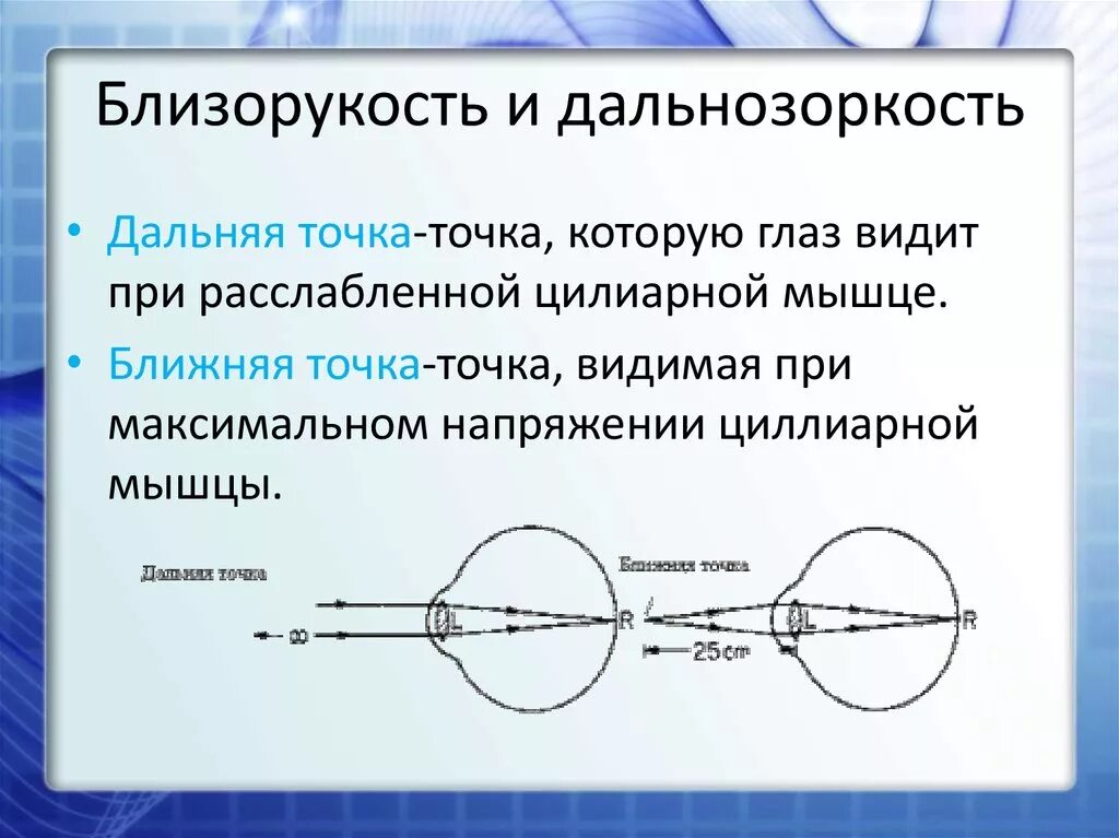 Близорукость и дальнозоркость. Схема близорукости и дальнозоркости. Глаз дальнозоркость и близорукость. Близорукость 2)  дальнозоркость.