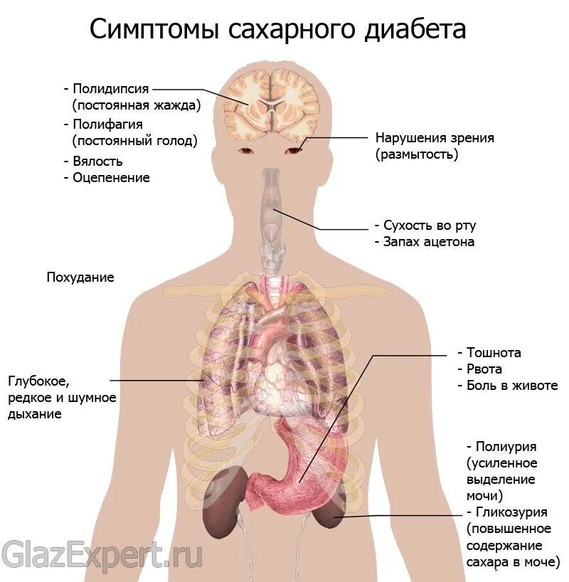 Каковы ее симптомы. Ранние симптомы сахарного диабета. симптомы сахарного диабе. сахарный диабет сиптом. признаки сахарного диабте.