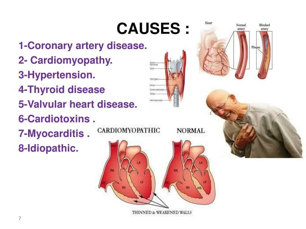 Heart disease causes. Сердце для инфографики. Heart disease causes. Risk factors of ptsd. Heart disease and diabetes.