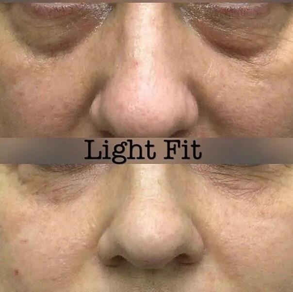 Препарат light fit липолитик. Light fit липолитик. Липолитик light fit 2 ml. Лайт фит липолитик. Липолитик лайт фит для второго подбородка.