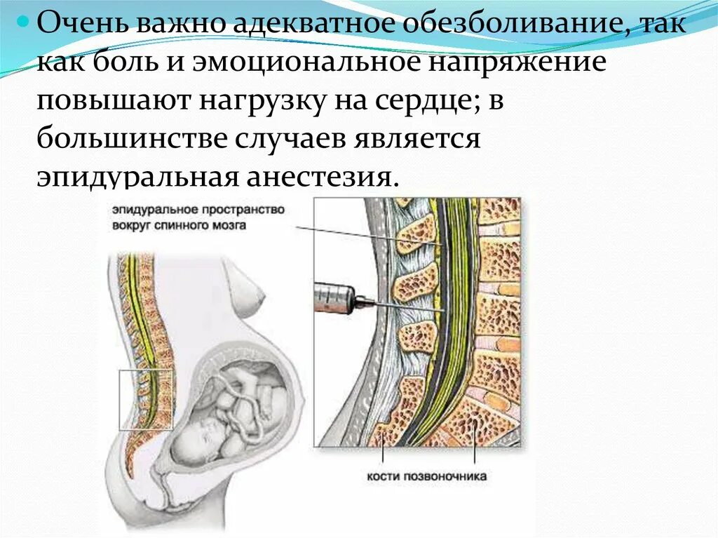 Эпидуралка болит спина. Спинальная и эпидуральная анестезия отличия. Субдуральная и эпидуральная анестезия. Эпидуральная и субарахноидальная анестезия. Субдуральная эпидуральная перидуральная анестезия.