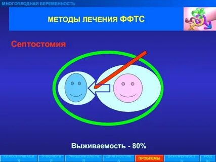 Классификация многоплодной беременности