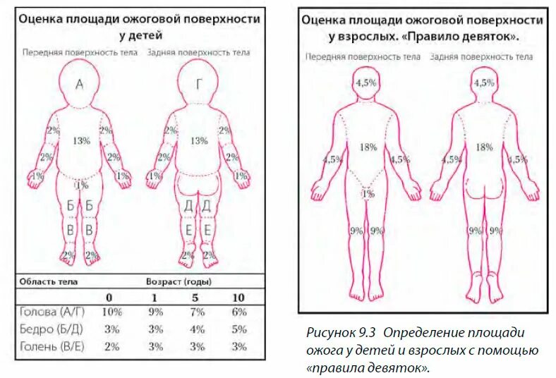 Ожоги проценты поражения. Площадь поражения ожогов у детей. Площадь ожога у детей таблица. Определение площади поражения при ожогах у детей. Площадь ожога поверхности тела у детей от 0-1.