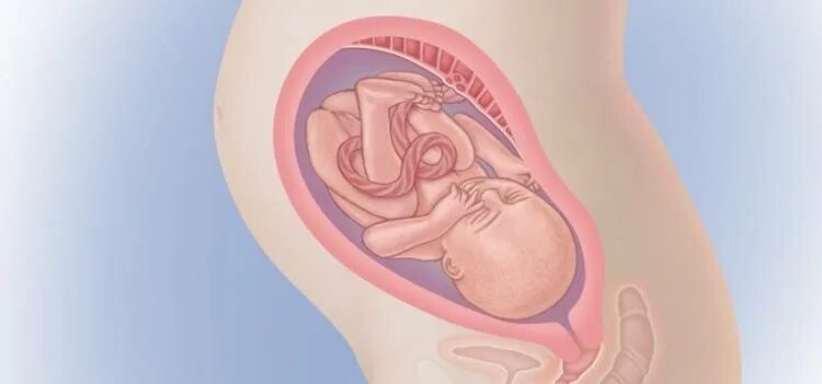 Расположение ребенка на 8 месяце. Расположение ребенка на 9 месяце. Расположение ребенка на 8 месяце беременности. Расположение ребенка на 7 месяце. Вода на 28 неделе