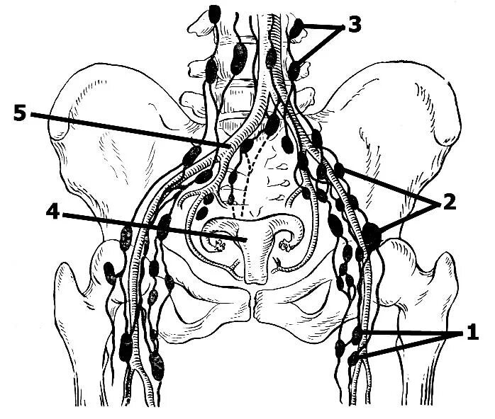 Лимфоузлы слева в паху. Парааортальные лимфоузлы брюшной полости. Пахово подвздошные лимфоузлы. Лимфатические узлы малого таза схема. Лимфатическая система малого таза мужчин.