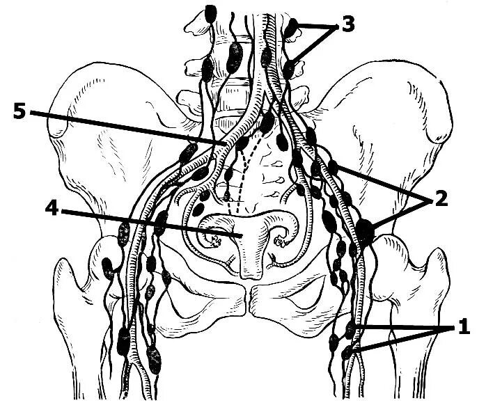 Лимфоузлы на пояснице. Парааортальные лимфоузлы брюшной полости. Пахово подвздошные лимфоузлы. Лимфатические узлы малого таза схема. Лимфатическая система малого таза мужчин.