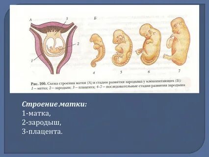 У человека в норме развивается матка