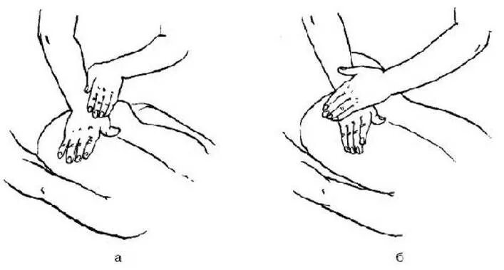 Классический массаж тест. Выжимание разминание прием массажа. Надавливание разминание в массаже. Приемы разминания в массаже спины. Надавливание разминание в массаже прием.