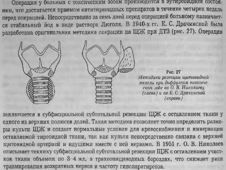 Резекция щитовидной железы по Драчинской. Резекция щитовидной железы по методике Драчинской е.с. Субтотальная резекция щитовидки. Удаление правой доли щитовидной