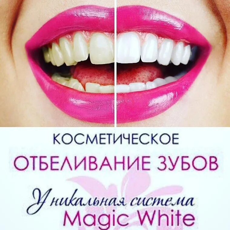 Отбеливание зубов реклама. Отбеливание зубов Magic White. Мэджик Вайт отбеливание зубов. Косметическое отбеливание зубов Magic White. Отбеливание зубов отзывы цены