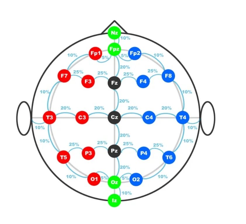 Схема 10-20 наложение электродов. Схема наложения электродов ЭЭГ. Схема расположения электродов при ЭЭГ 10-20. ЭЭГ отведения 10-20.