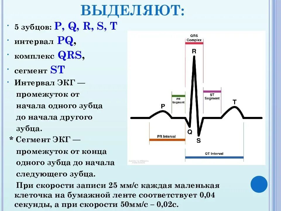 Норма длительности экг. Отрицательный зубец р после qrs комплекса. зубцы экг в норме. ось qrs норма экг. экг расшифровка aqrs норма.