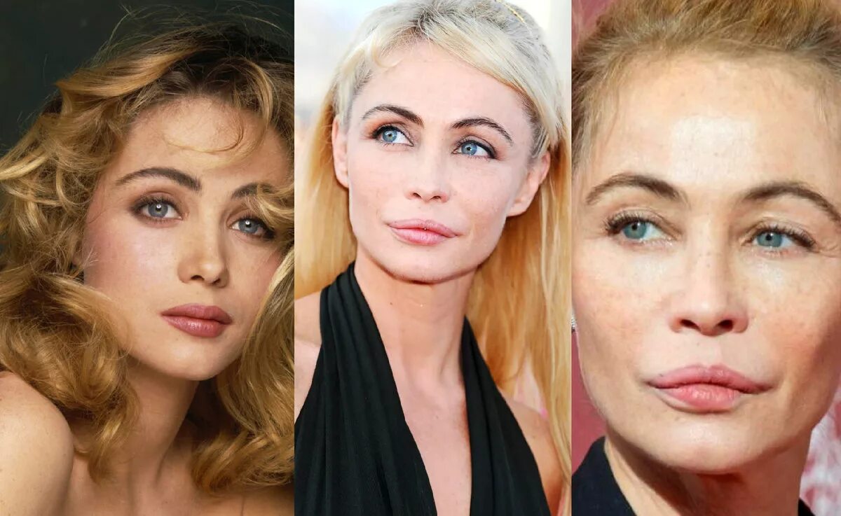 Улучшения после