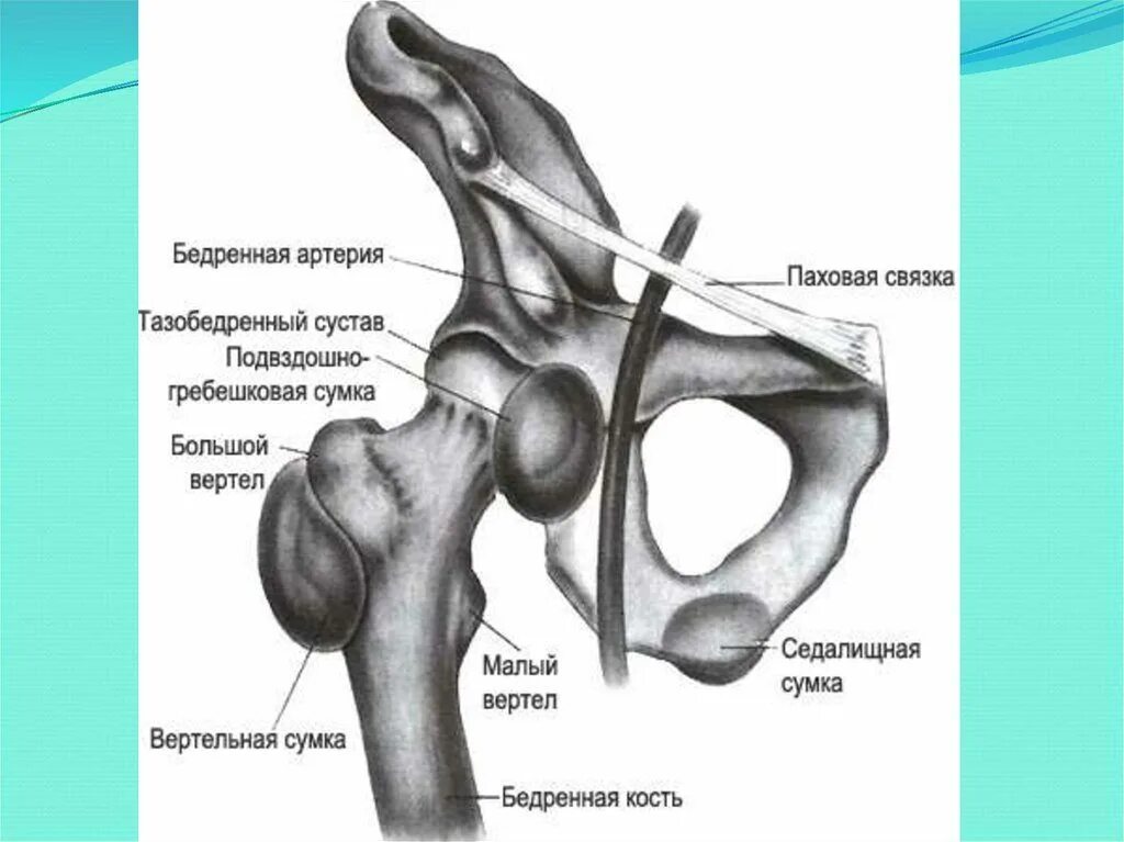 Тазобедренный сустав соединение. Подвздошно-гребешковая сумка тазобедренного сустава. Вертельная сумка тазобедренного сустава анатомия. Анатомия тазобедренного сустава кости. Бурсит тазобедренного сустава.