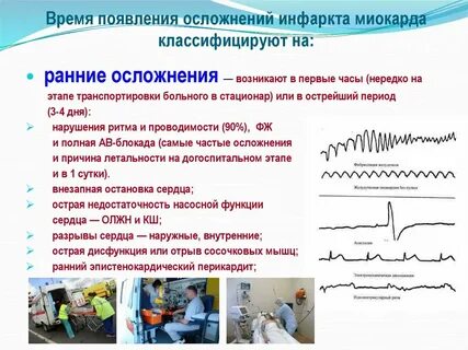 Ранний инфаркт миокарда