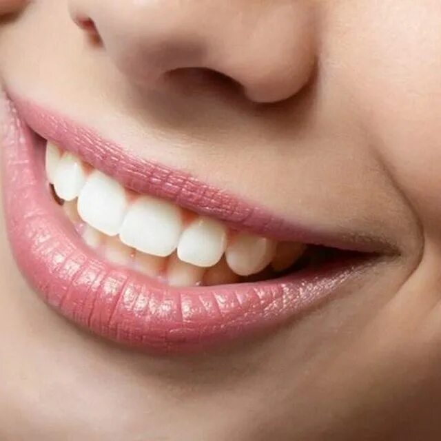 Зубы спб. Голливудская улыбка имплантация. Улыбка Суксун стоматология телефон.