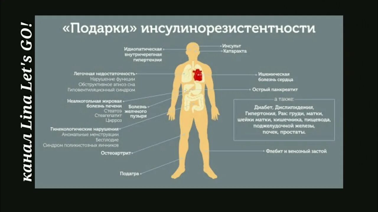 Как лечить инсулинорезистентность у женщин после 40. Инсулинорезистентность. симптомы инсулинорезистентности. инсулинорезистентность симптомы. инсулинорезистентность фото.