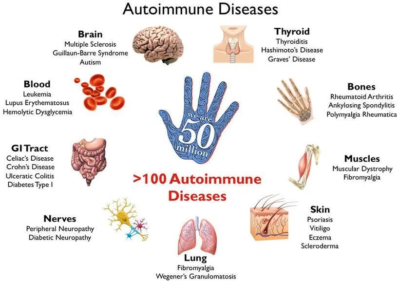 Autoimmune disease. Аутоиммунный протокол. Аутоиммунные болезни иллюстрации. Autoimmune disease diagnostic steps. Autoimmune disease.