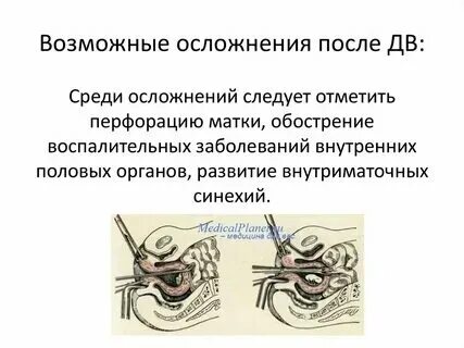 Болит матка после чистки матки