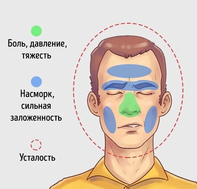 Сильно болит бровь. Синусовая головная боль. Синусная головная боль. Болит голова в области носа.