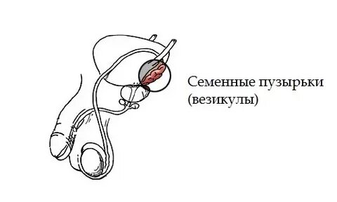 Пузырьки у мужчин