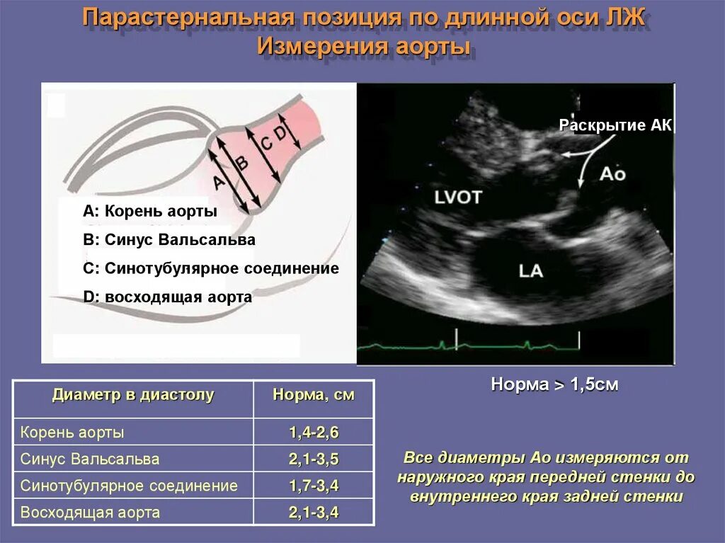 Как проходят эхо. Аортальный клапан норма ЭХОКГ сердца. Парастернальная позиция в ЭХОКГ. Парастернальная позиция по длинной оси на ЭХОКГ. Измерение корня аорты на ЭХОКГ.