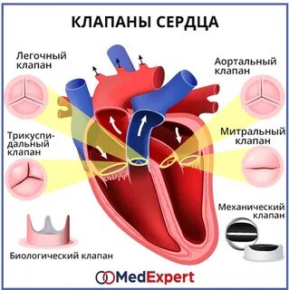 Порок сердечных клапанов