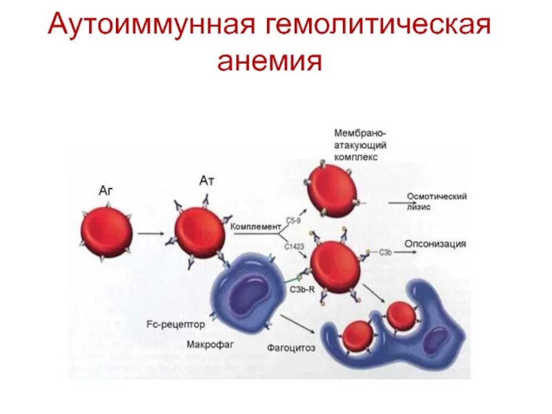 Гемолитическая анемия. Аутоиммунная гемолитическая анемия патогенез. Механизм развития аутоиммунной гемолитической анемии. Приобретенная аутоиммунная гемолитическая анемия патогенез. Аутоиммунная гемолитическая анемия схема.