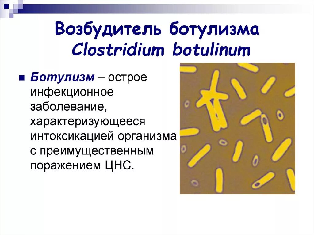 Клостридия ботулинум микробиология. Clostridium botulinum характеристика. Спорообразующие бактерии Clostridium botulinum.
