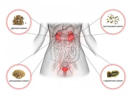 Почки человека как лечить - Фото и картинки