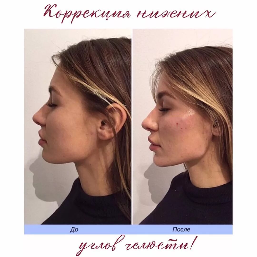 Увеличение довольно