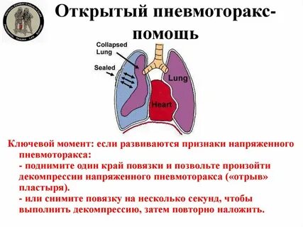 Уход при пневмотораксе
