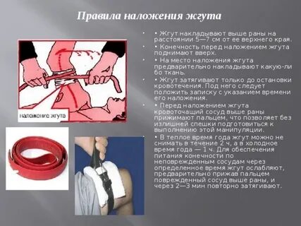Артериальное кровотечение жгут накладывается выше раны