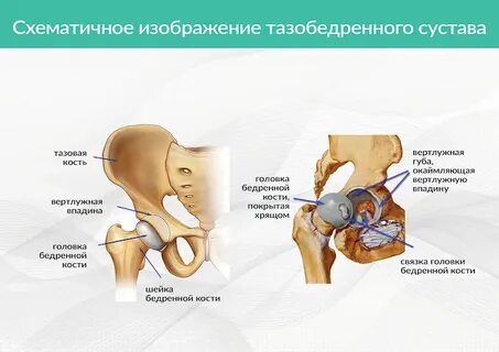 Тазобедренный сустав тип соединения