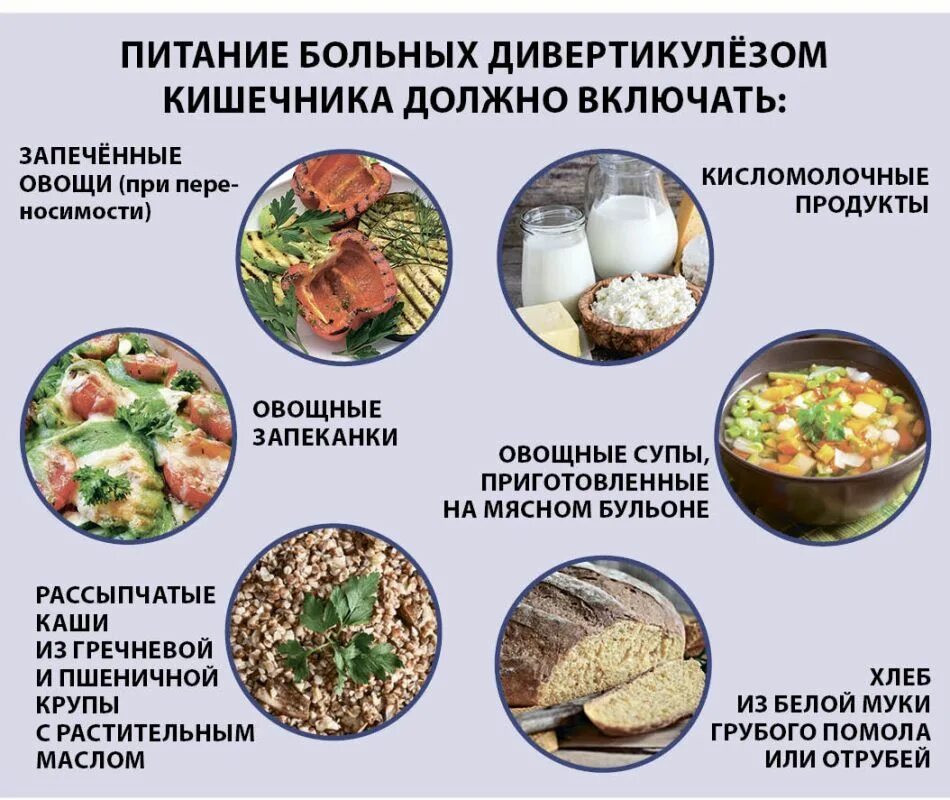 Диета при остром дивертикулите. Запрещенные продукты при дивертикулите. Диета при дивертикулах кишечника. Питание при дивертикулезе кишечника.